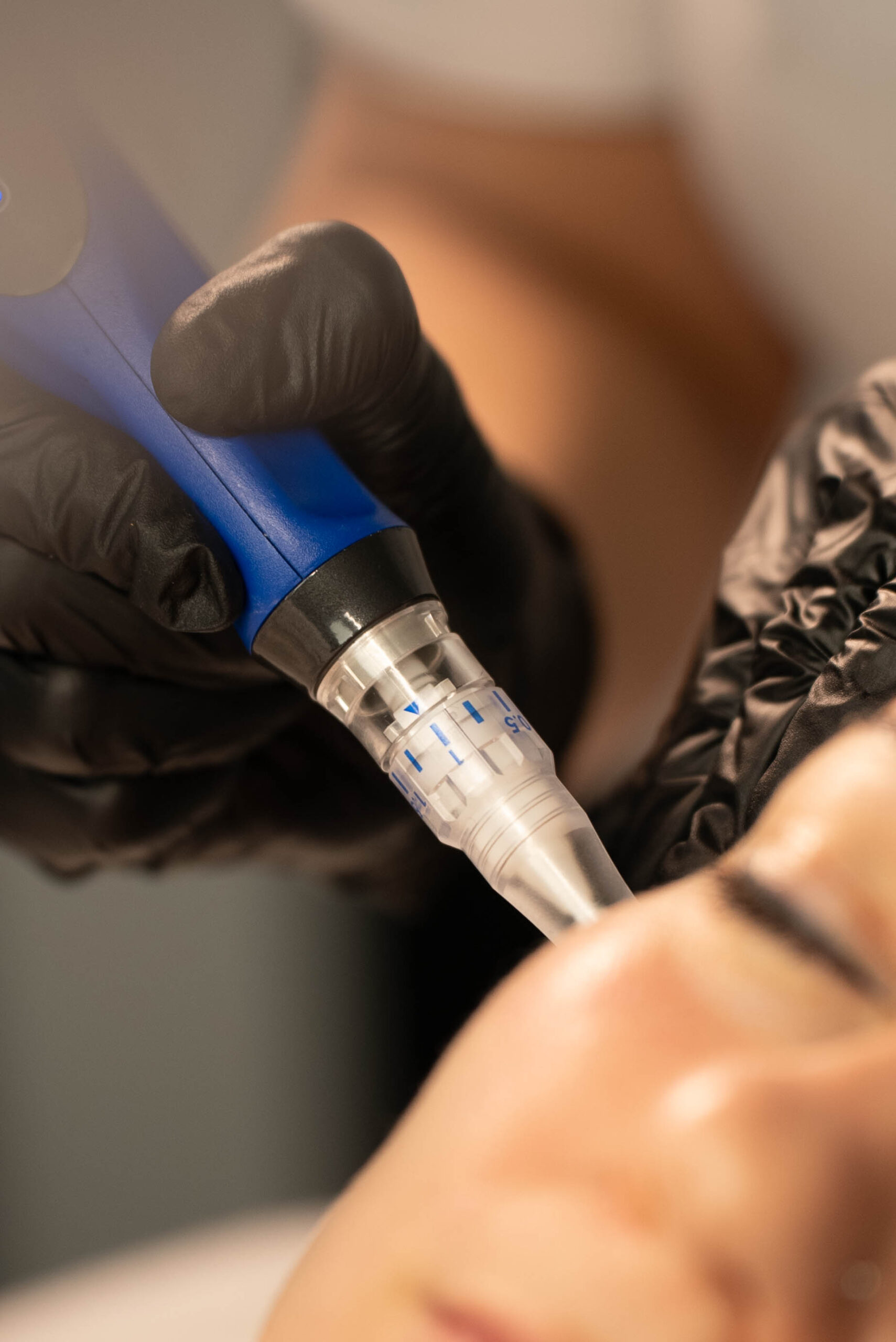 Close-up van SkinPen microneedling behandeling in Den Haag