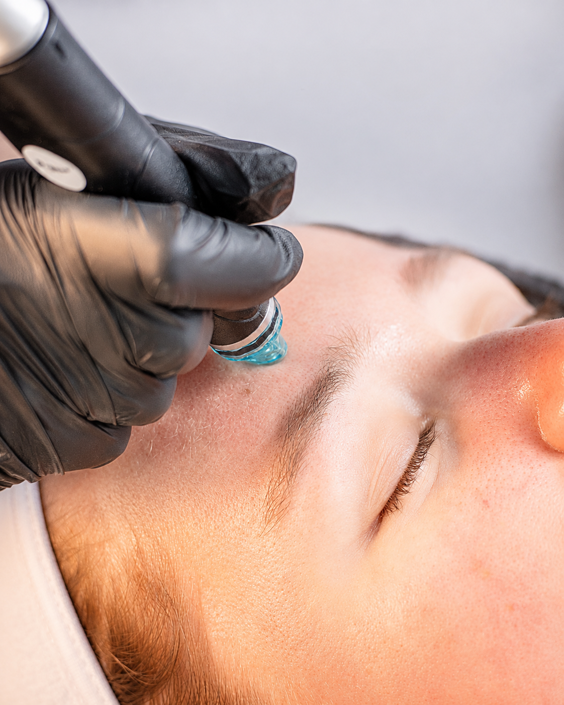 HydraFacial huidverzorging en frisse uitstraling in Den Haag