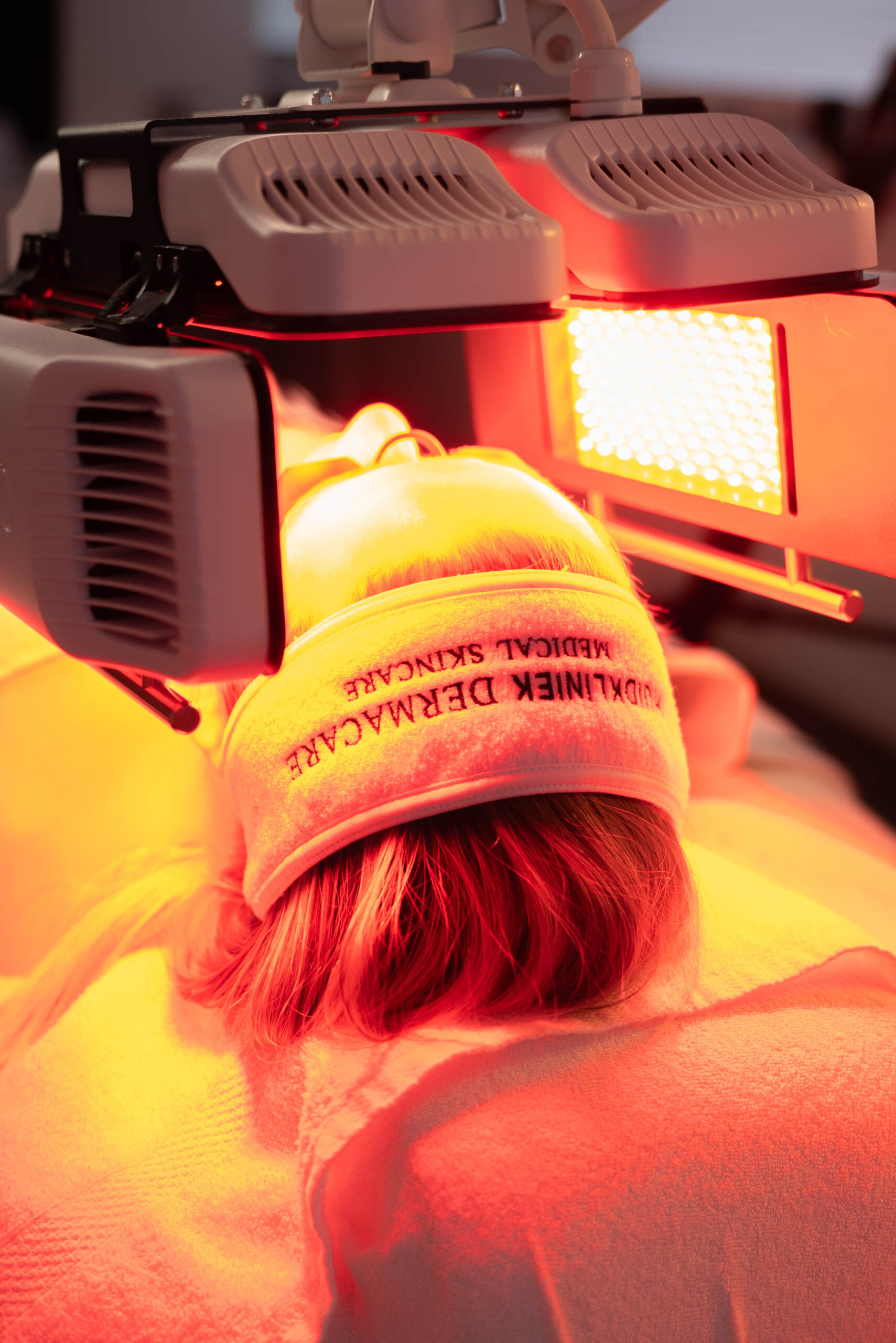 Dermalux Tri-Wave LED bij Meso-Haar behandeling Dermacare