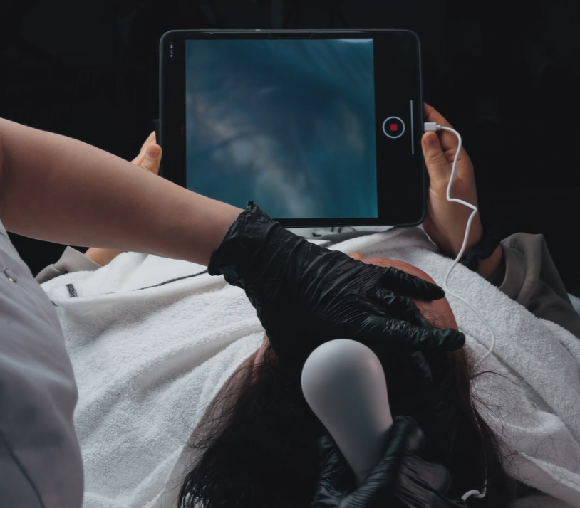 Scalp check voor haaruitval behandeling in Den Haag